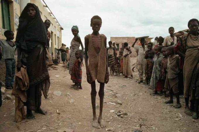 Θύματα του λιμού που προέκυψε από τον εμφύλιο πόλεμο της Σομαλίας.